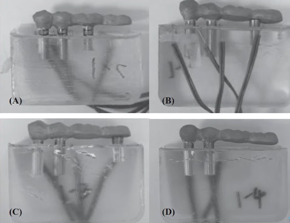 Four experimental setups showing dental implant cantilever load testing with varying lengths in water-filled containers