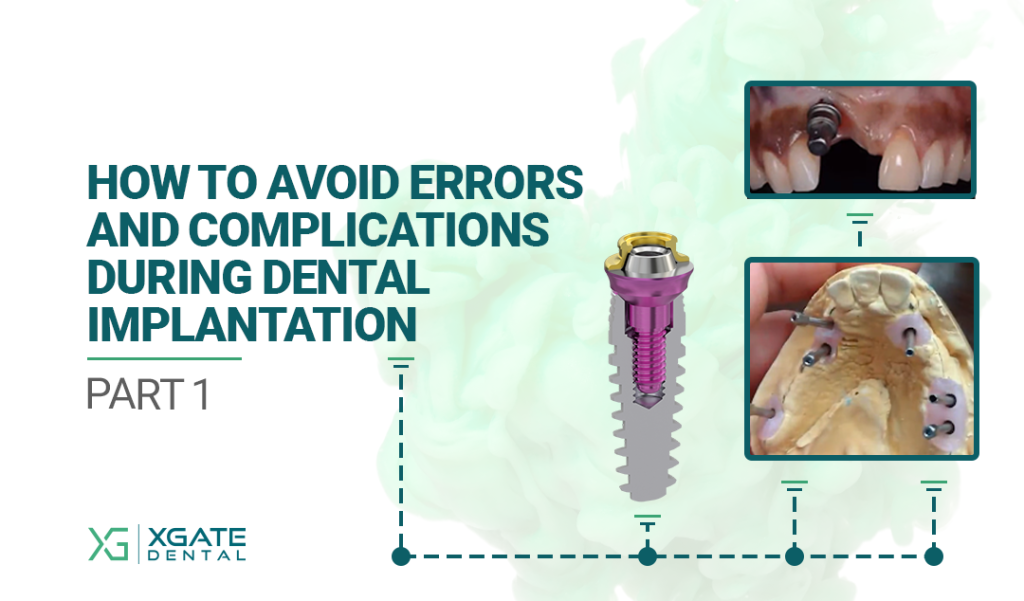 How to Avoid Errors and Complications During Dental Implantation