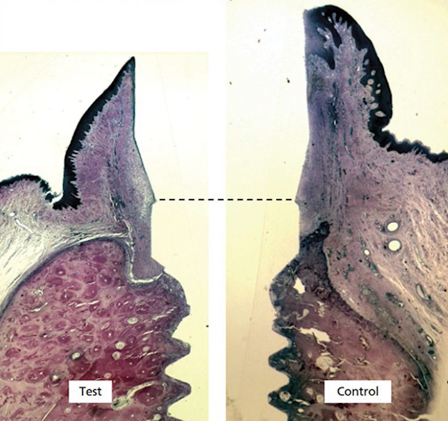 Histological comparison showing marginal bone loss around dental implant in test group versus preserved bone in control group