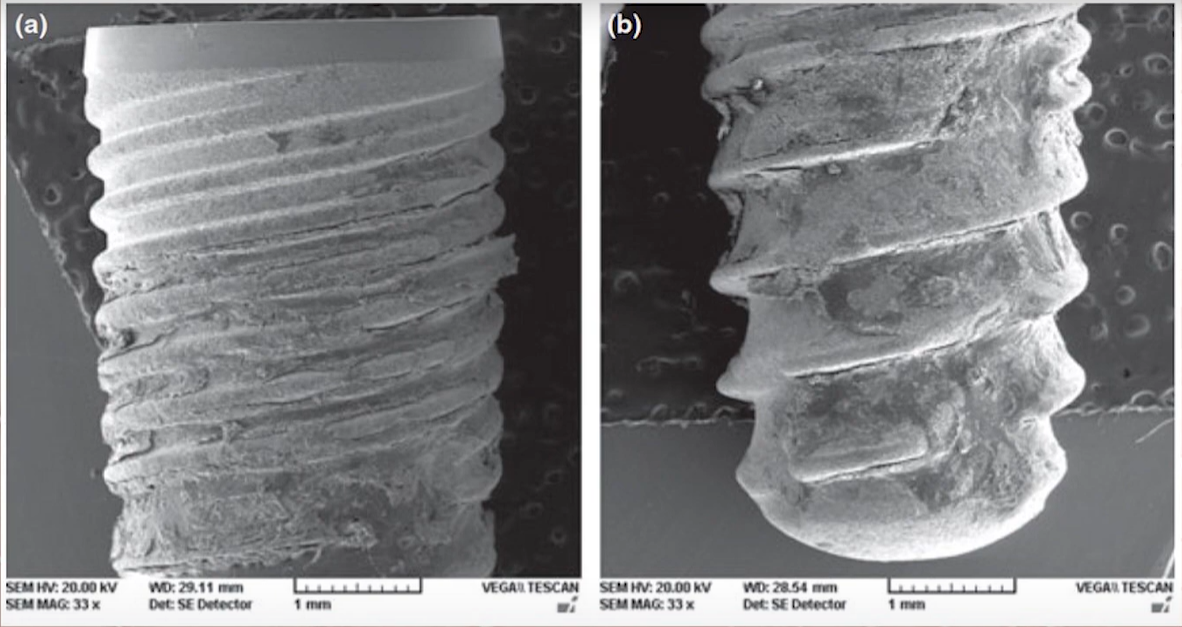 Electron microscope views showing bone integration around retrieved dental implant