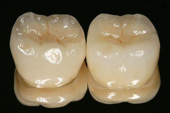 Two glossy lithium disilicate posterior crowns showing enamel-like translucency on a black background.