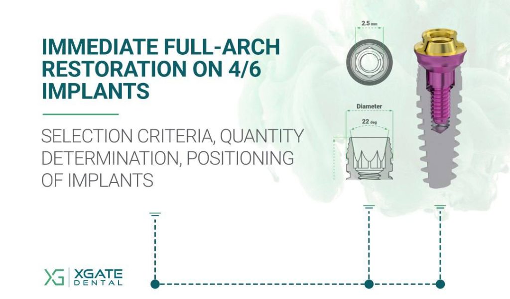 Immediate Full-Arch Restoration on 4/6 Implants. Part 2