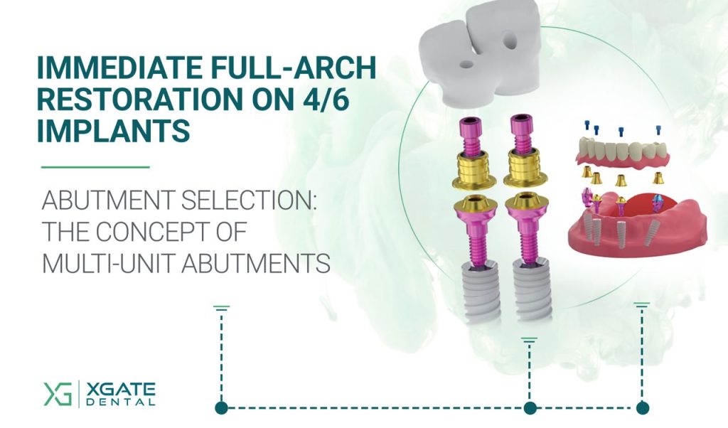 Immediate Full-Arch Restoration on 4/6 Implants. Part 3