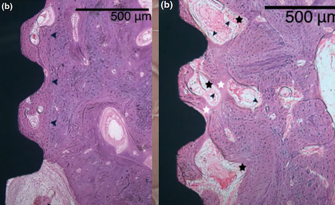 Histological comparison showing bone healing around spinning dental implant placement sites