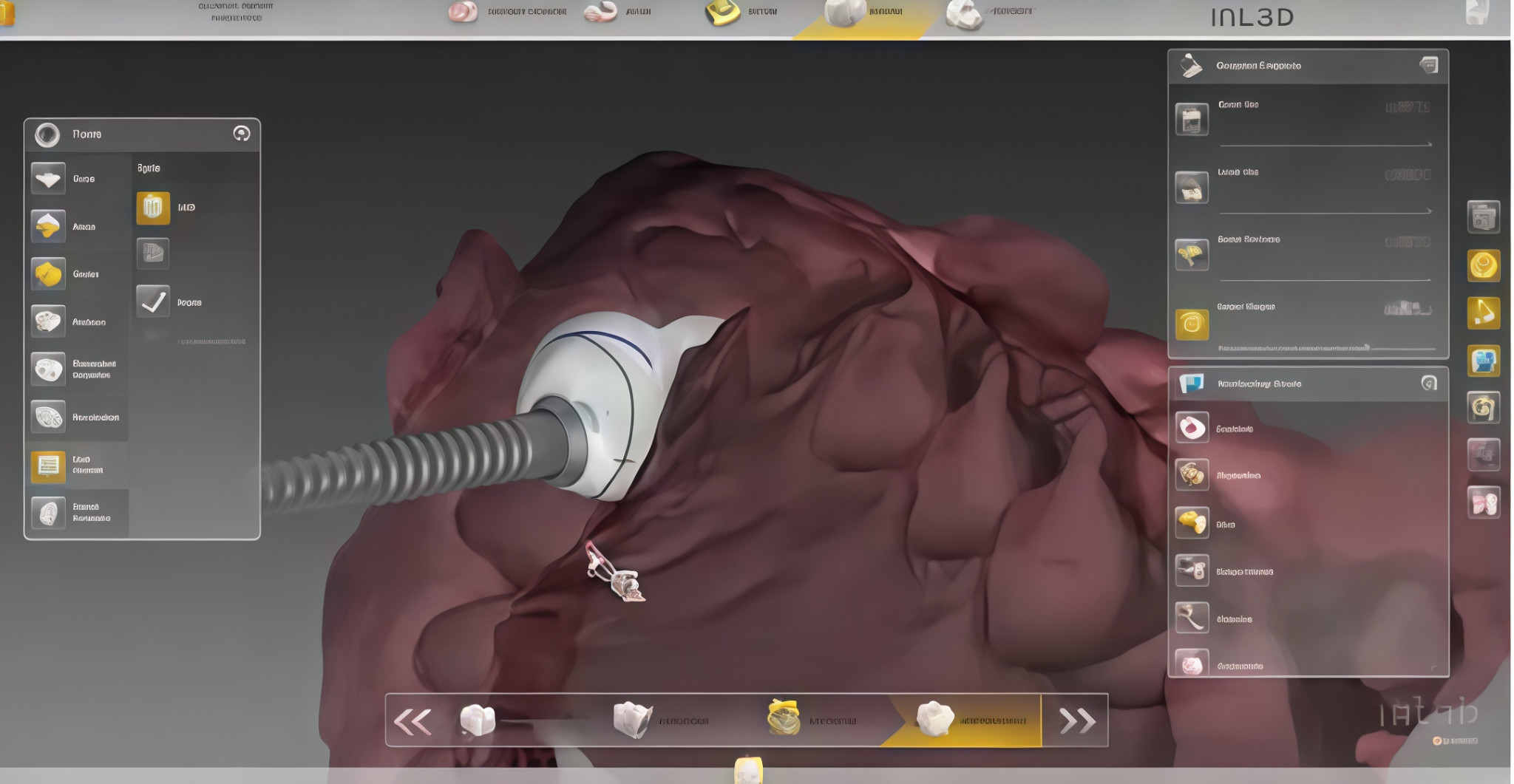 CAD view of the implant fixture and provisional crown in a virtual model with adjacent structures faded out.