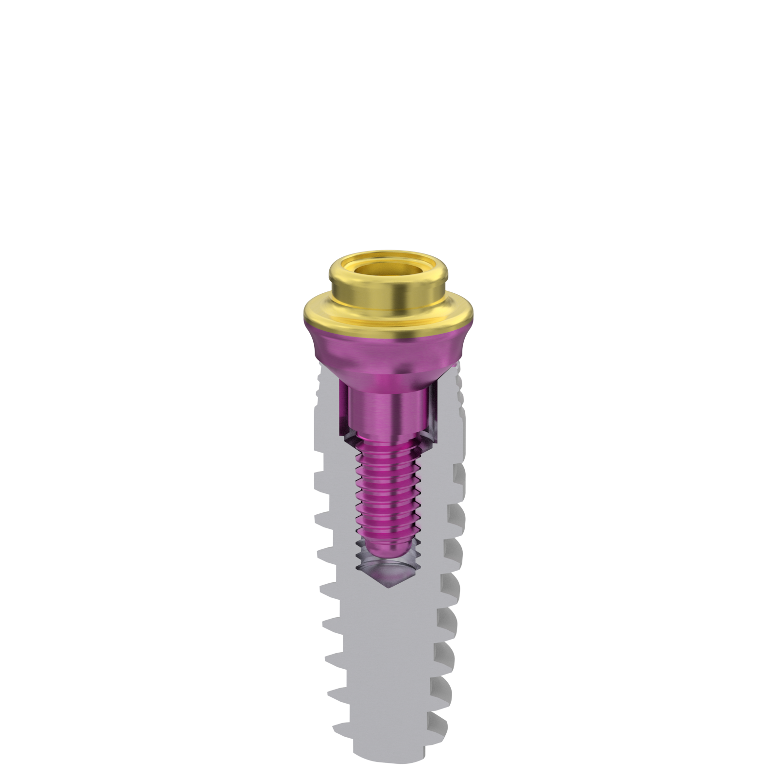 Rendered implant cross-section with the MUA V-type abutment seated inside.