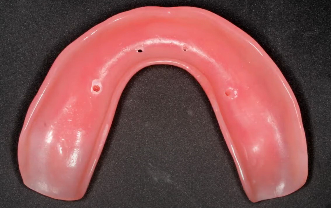 Marking for future screw access channels