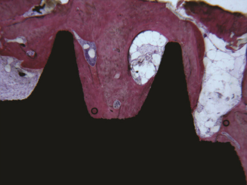 Compact bone in the medial thirds and apical portion of the implant were evident. No gaps were present at the interface. Acid fuchsin-toluidine blue 40x. YouTube / Dr. Kamil Khabiev / Dental Guru Academy