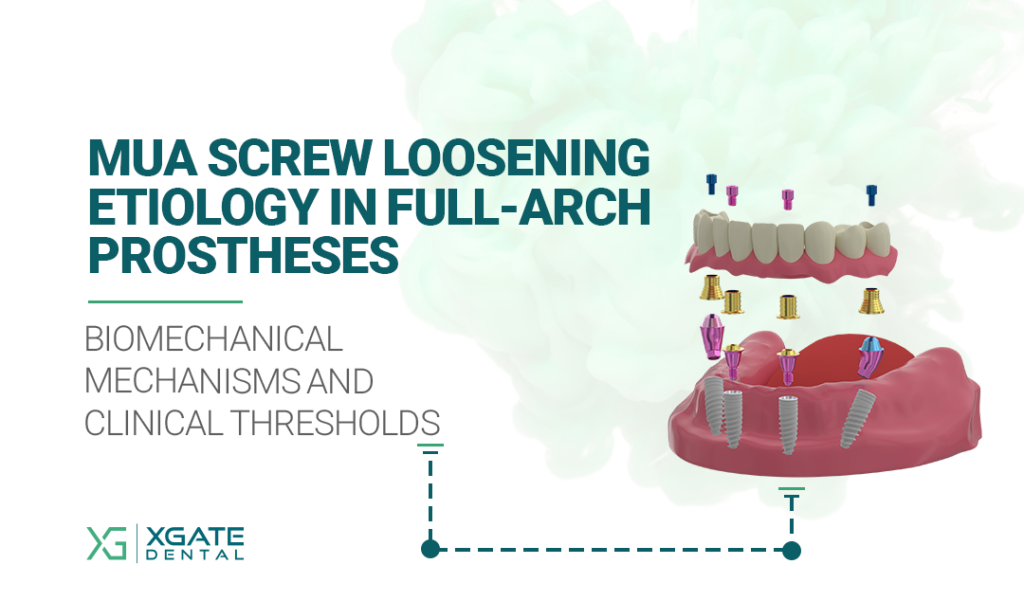 MUA Screw Loosening Etiology in Full-Arch Prostheses: Biomechanical Mechanisms and Clinical Thresholds
