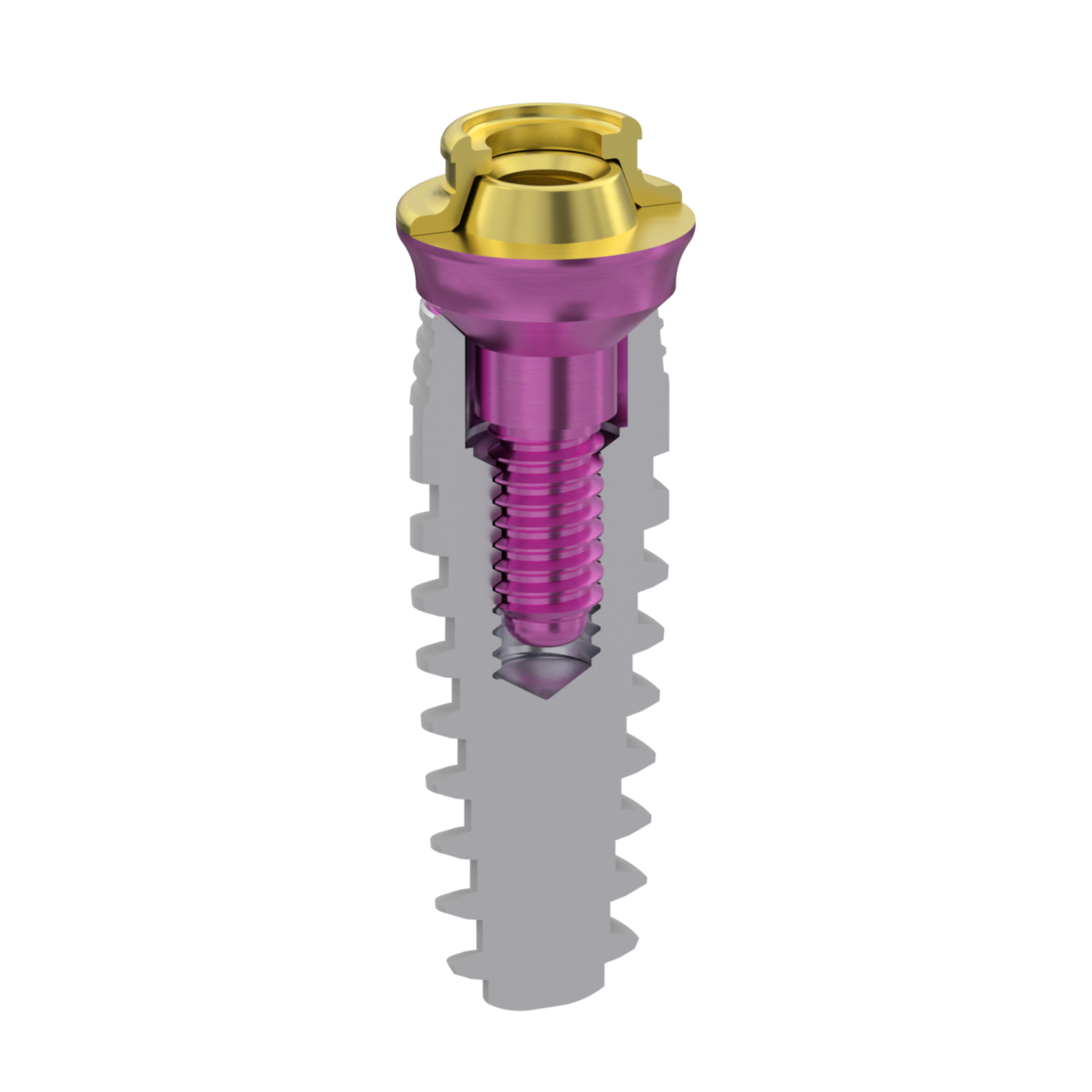 Implant diameter, length, and positioning criteria for full-arch restoration on 4/6 implants
