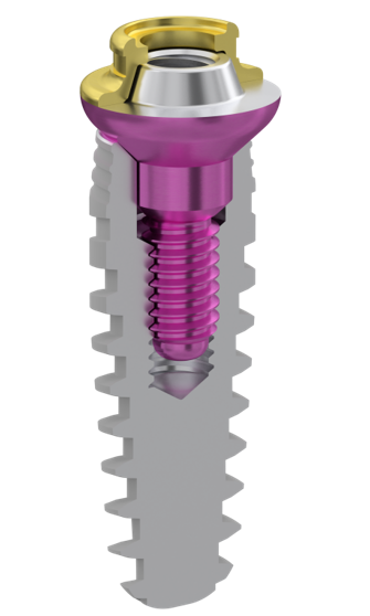 MUA V-type dental implant with 0.5mm extra-low sleeve design