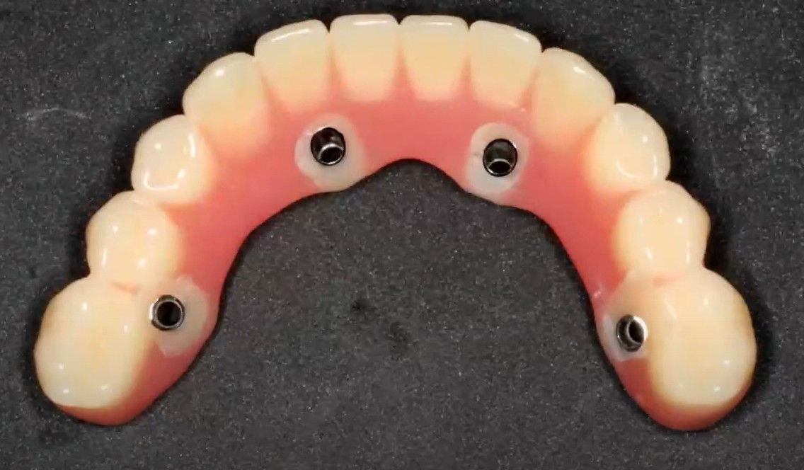 Polished denture intaglio view