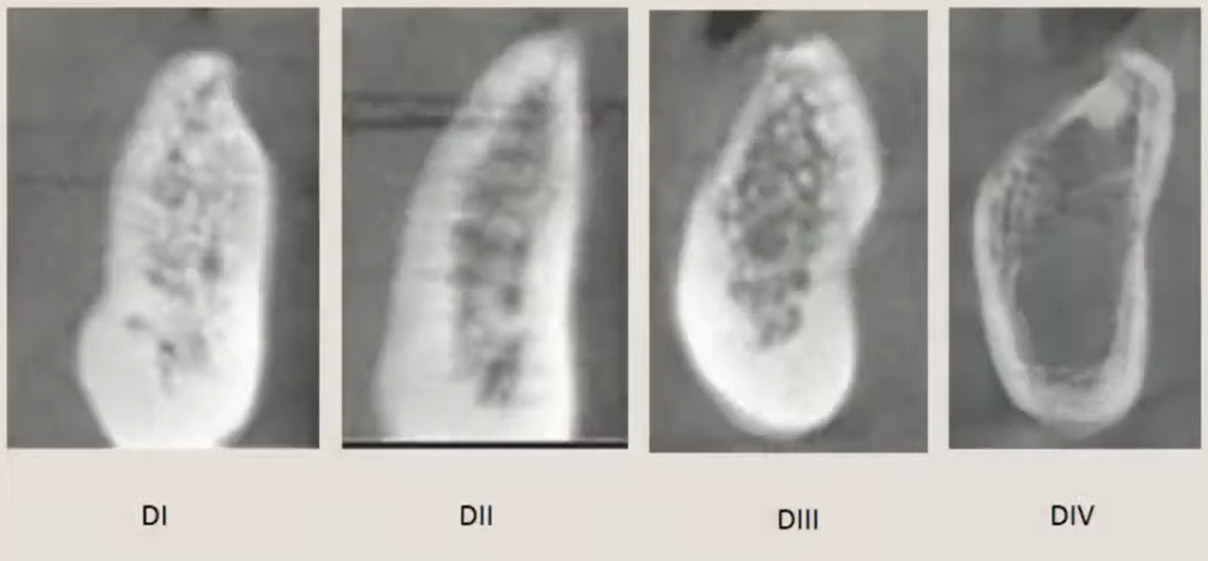 Radiographs of different bone types