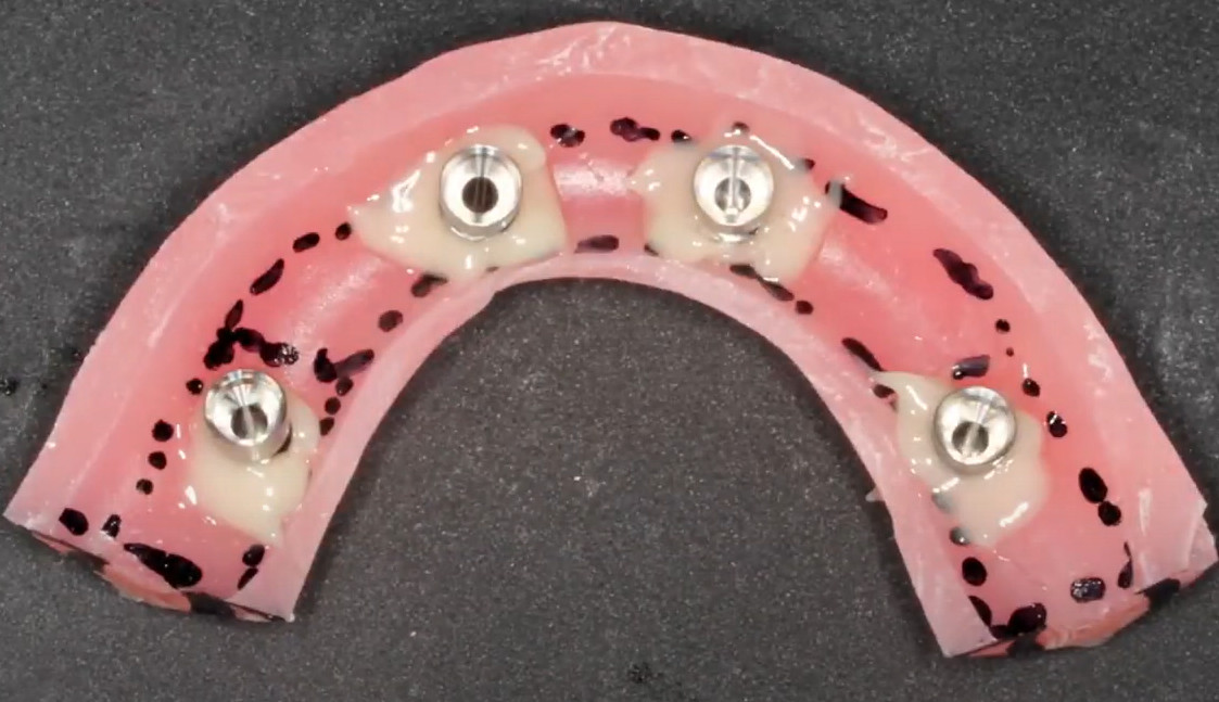 Securing the cylinders in the body of the prosthesis