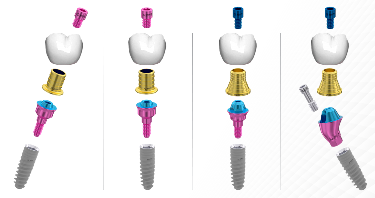 Exploded diagram of screw-retained prostheses on straight and angled multi-unit abutments.