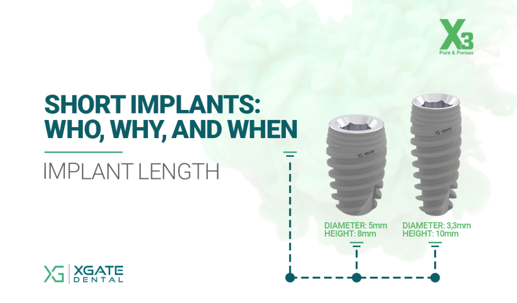 Short Implants: Who, Why, and When (Implant Length). XGATE Dental