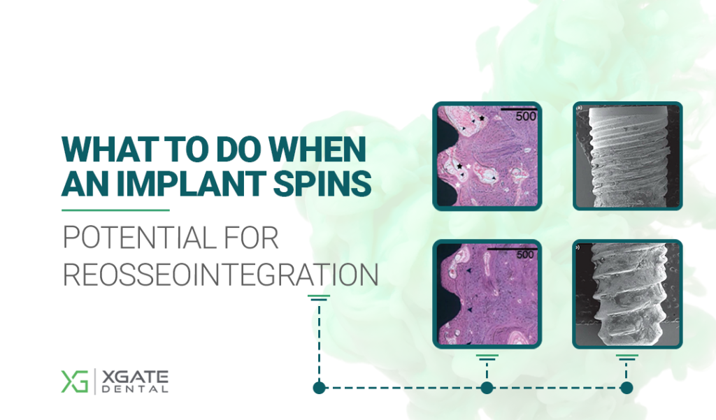 What to Do When an Implant Spins: What We Know About the Potential for Reosseointegration