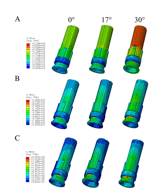 The stress distribution of the prosthesis abutment of the MUA-implant complex models with different angulation (0°, 17° and 30°). A, The stress distribution of the prosthesis abutment under loading condition A. B, The stress distribution of the prosthesis abutment under loading condition B. C, The stress distribution of the prosthesis abutment under loading condition C. Research Square/ rs-4446322/v1/ Dong Lin/ Jun 2024