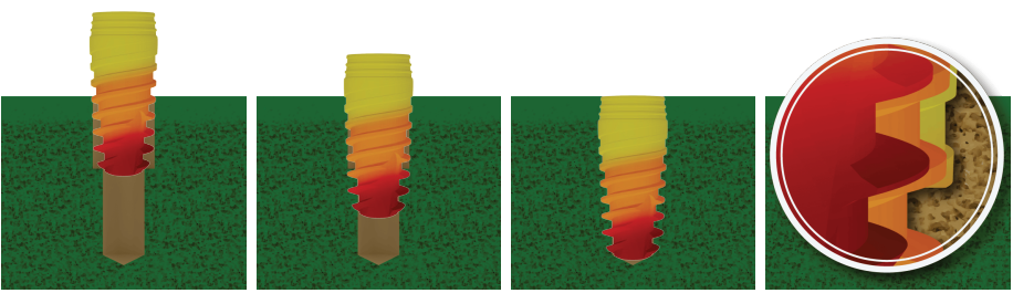 The principle of a variable thread profile: sharp, cutting threads at the