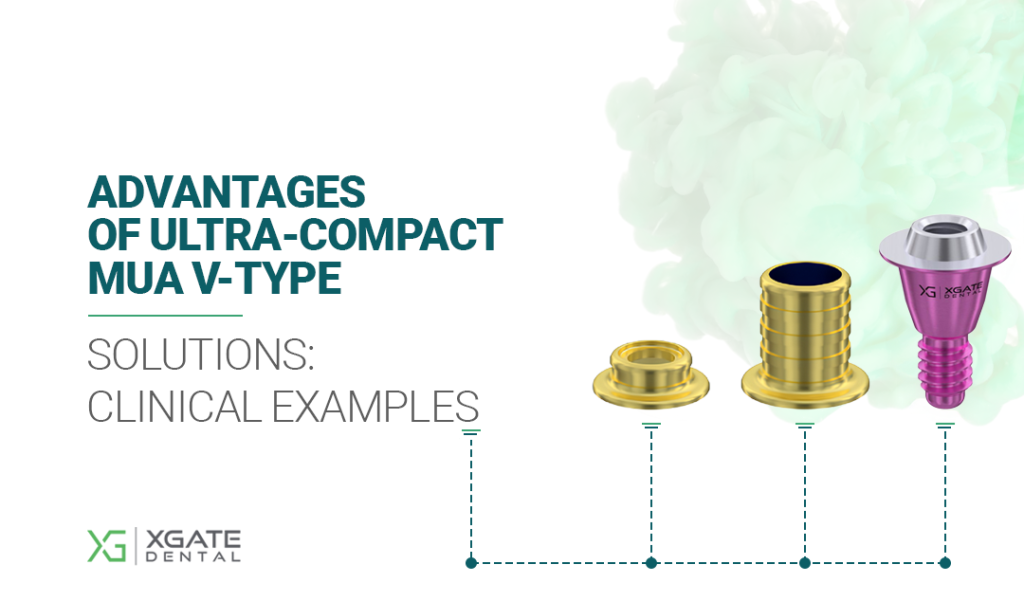 Advantages of Ultra-Compact MUA V-Type Solutions: Clinical Examples