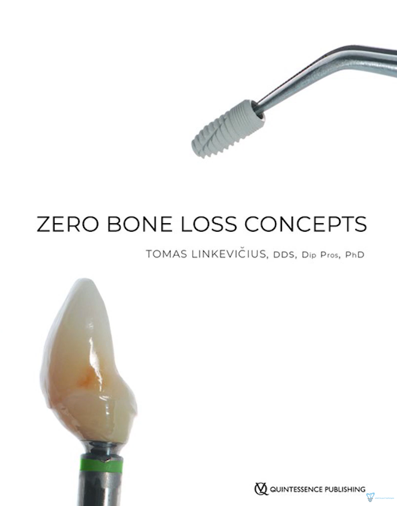 Zero Bone Loss Concepts book cover showing dental implant tool and crown by Dr. Tomas Linkevičius