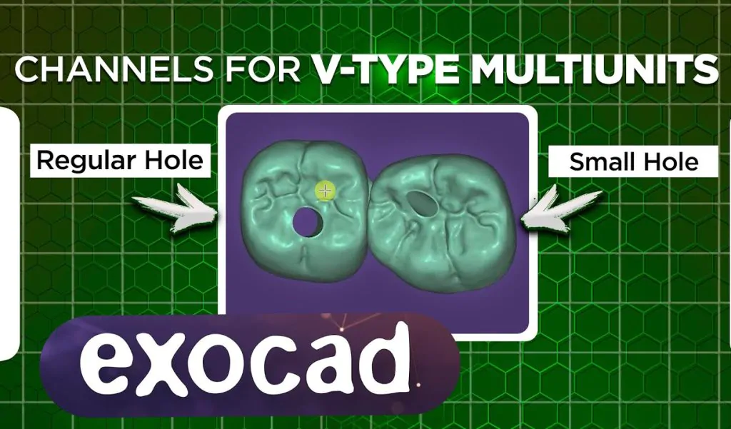 Choosing between regular and small screw channels for V-type multi units.