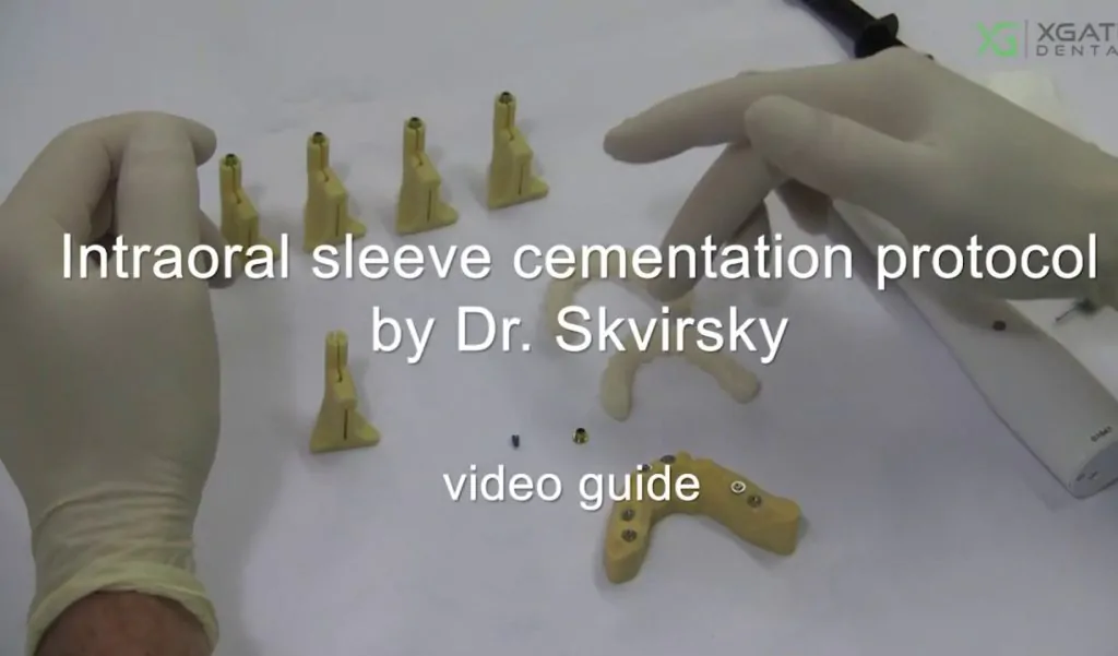 Intraoral sleeve cementation protocol, video guide